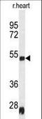 Serpin Family H Member 1 antibody, LS-C168975, Lifespan Biosciences, Western Blot image 