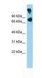 ATP Binding Cassette Subfamily B Member 8 antibody, orb330330, Biorbyt, Western Blot image 