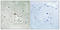 Neurotrophic Receptor Tyrosine Kinase 2 antibody, LS-C199688, Lifespan Biosciences, Immunohistochemistry paraffin image 
