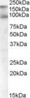 CUB Domain Containing Protein 1 antibody, PA5-17993, Invitrogen Antibodies, Western Blot image 