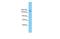 Slit Guidance Ligand 3 antibody, NBP1-59140, Novus Biologicals, Western Blot image 