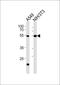 T-Box 4 antibody, PA5-35223, Invitrogen Antibodies, Western Blot image 