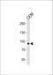 Matrilin 2 antibody, PA5-35280, Invitrogen Antibodies, Western Blot image 