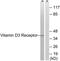 Vitamin D Receptor antibody, TA326072, Origene, Western Blot image 