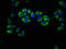 Lipase H antibody, LS-C674653, Lifespan Biosciences, Immunofluorescence image 
