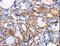 Adaptor Related Protein Complex 1 Subunit Beta 1 antibody, LS-C405423, Lifespan Biosciences, Immunohistochemistry paraffin image 