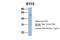 Interferon Induced Protein With Tetratricopeptide Repeats 5 antibody, NBP1-58887, Novus Biologicals, Western Blot image 