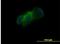 Cadherin 11 antibody, H00001009-M02-100ug, Novus Biologicals, Immunocytochemistry image 