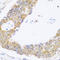 Mitogen-Activated Protein Kinase Kinase Kinase 20 antibody, LS-C349093, Lifespan Biosciences, Immunohistochemistry frozen image 