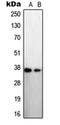 STEAP Family Member 1 antibody, orb215124, Biorbyt, Western Blot image 