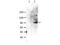 Signal Transducer And Activator Of Transcription 6 antibody, TA319167, Origene, Western Blot image 