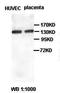 RB Binding Protein 6, Ubiquitin Ligase antibody, orb76916, Biorbyt, Western Blot image 