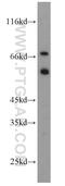 E3 ubiquitin-protein ligase MGRN1 antibody, 11285-1-AP, Proteintech Group, Western Blot image 