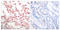 Nuclear Factor Kappa B Subunit 2 antibody, LS-C117426, Lifespan Biosciences, Immunohistochemistry paraffin image 