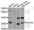 HAUS Augmin Like Complex Subunit 4 antibody, A8226, ABclonal Technology, Western Blot image 