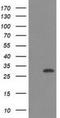 CTD Small Phosphatase 1 antibody, NBP2-03456, Novus Biologicals, Western Blot image 