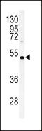 Diacylglycerol O-acyltransferase 2 antibody, LS-C167377, Lifespan Biosciences, Western Blot image 