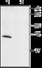 Potassium Voltage-Gated Channel Interacting Protein 1 antibody, GTX16713, GeneTex, Western Blot image 