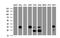 Palmitoyl-protein thioesterase 1 antibody, NBP2-45388, Novus Biologicals, Western Blot image 