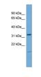 Neuronal Growth Regulator 1 antibody, orb330814, Biorbyt, Western Blot image 