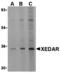 Ectodysplasin A2 Receptor antibody, MBS151283, MyBioSource, Western Blot image 