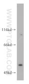 Dynactin Subunit 2 antibody, 11361-1-AP, Proteintech Group, Western Blot image 