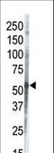 Casein Kinase 1 Gamma 3 antibody, LS-C100602, Lifespan Biosciences, Western Blot image 