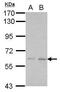 Kelch Domain Containing 7B antibody, GTX107142, GeneTex, Western Blot image 