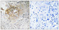Sodium Voltage-Gated Channel Alpha Subunit 9 antibody, abx014897, Abbexa, Western Blot image 