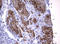 TNF Receptor Superfamily Member 8 antibody, LS-C175669, Lifespan Biosciences, Immunohistochemistry frozen image 