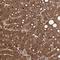 Ro60, Y RNA Binding Protein antibody, NBP1-86998, Novus Biologicals, Immunohistochemistry paraffin image 