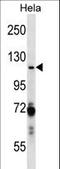 Poly(ADP-Ribose) Polymerase 1 antibody, LS-C158535, Lifespan Biosciences, Western Blot image 