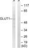 Solute Carrier Family 2 Member 1 antibody, LS-B8385, Lifespan Biosciences, Western Blot image 