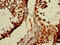 WT1 Associated Protein antibody, CSB-PA618970LA01HU, Cusabio, Immunohistochemistry frozen image 