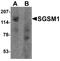 Small G Protein Signaling Modulator 1 antibody, A12048, Boster Biological Technology, Western Blot image 