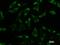 DEAD-Box Helicase 3 X-Linked antibody, LS-C342478, Lifespan Biosciences, Immunofluorescence image 