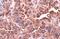 CD63 Molecule antibody, GTX132953, GeneTex, Immunohistochemistry paraffin image 