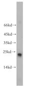 Ras-related protein Rab-9A antibody, 18719-1-AP, Proteintech Group, Western Blot image 