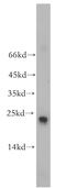 RAB9A, Member RAS Oncogene Family antibody, 18719-1-AP, Proteintech Group, Western Blot image 