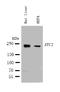 TSC Complex Subunit 2 antibody, LS-C313292, Lifespan Biosciences, Western Blot image 