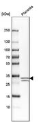Cyclin Dependent Kinase Inhibitor 1C antibody, NBP1-89917, Novus Biologicals, Western Blot image 