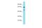 Fidgetin Like 2 antibody, A19271, Boster Biological Technology, Western Blot image 