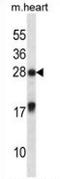 MAX Interactor 1, Dimerization Protein antibody, AP52782PU-N, Origene, Western Blot image 