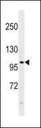 Fibroblast Growth Factor Receptor 4 antibody, PA5-14656, Invitrogen Antibodies, Western Blot image 