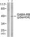 Gamma-aminobutyric acid receptor subunit beta-1 antibody, PA5-38068, Invitrogen Antibodies, Western Blot image 