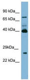 Transglutaminase 3 antibody, TA346349, Origene, Western Blot image 