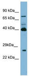 Transglutaminase-3 antibody, TA346349, Origene, Western Blot image 