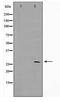 Homeobox D12 antibody, TA347718, Origene, Western Blot image 