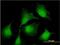 Serine/threonine-protein kinase RIO2 antibody, H00055781-M02, Novus Biologicals, Immunocytochemistry image 