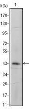 Integrin Subunit Alpha 5 antibody, GTX83192, GeneTex, Western Blot image 